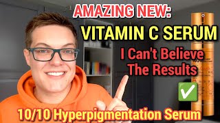 ULTIMATE HYPERPIGMENTATION SERUM  Next Level Korean Skincare Vitamin C [upl. by Selden]