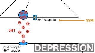 Major Depression and SSRIsSNRIs [upl. by Yellek]