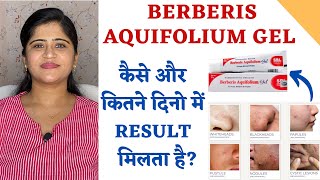 Berberis Aquifolium Gel for Acne and Scars ॥ कैसे और कितने दिनो में Result मिलता है [upl. by Aleunam]