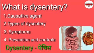 What is dysentery पेचिस किया है full explain in hindi [upl. by Murry]