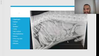 Chapter 6 Lets study X rays 13 الجدPeritonealamp retroperitoneal free fluid amp gas سوائل هواء البطن [upl. by Iraam]