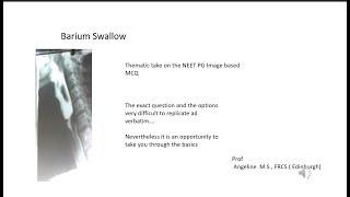 Barium Swallow NEET PG Recall [upl. by Adis]