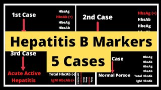 Hepatitis B Markers I Viral Markers Test I Diagnose Hepatitis B I HBV [upl. by Huoh71]