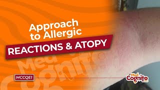 Approach to Allergic Reactions amp Atopy  MCCQE1 [upl. by Iramo426]