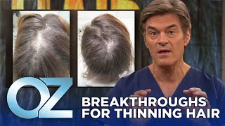 New Breakthroughs for Thinning Hair  Oz Health [upl. by Chak]