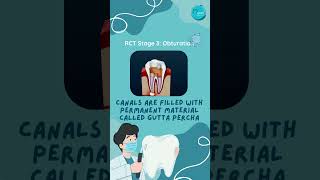 Root Canal Treatment  Steps [upl. by Llerred491]