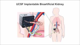 Developing an artificial kidney Part 3 with Dr Morteza Ahmadi [upl. by Anesor185]