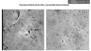 Cell culture  HaCaT Cell Differentiation [upl. by Halle974]