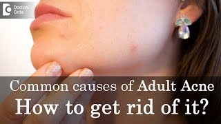 Common causes of Adult Acne and How to get rid of it  Dr Rasya Dixit [upl. by Aelram]