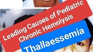 Leading Causes of Pediatric Chronic Hemolysis [upl. by Aserret]