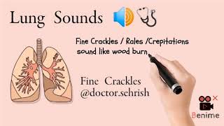 Fine Crackles  Fine Crepitations  Fine Rales  Lung sounds [upl. by Aguie108]