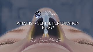 What is a septal perforation plug [upl. by Riatsala72]