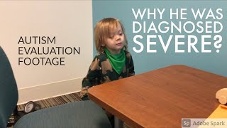 AUTISM EVALUATION FOOTAGE  Diagnosed With Level 3 Severe Autism  WHY They Diagnosed Him Level 3 [upl. by Rollet]