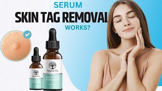 Serum Skin Tag Removal  Skinfix Skin Tag Remover [upl. by Nallak521]