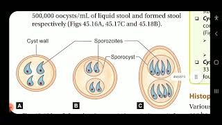 Apurba S Sastry Microbiology Intestinal protozoan infections part 2 [upl. by Oleusnoc]