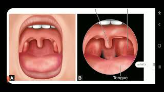 Apurba S Sastry Microbiology Infective Syndromes of Respiratory Tract part1 [upl. by Laddy496]