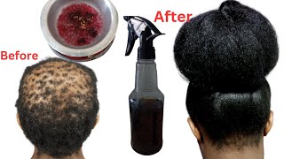 Her dermatologist didnt help She used this natural hair treatment her hair is so long and bushy [upl. by Nivled277]