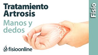 Tratamiento de fisioterapia para la artrosis de manos y dedos [upl. by Aysan807]