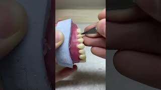 Wax up and carving in prosthodontics shorts prosthodontics viral trending bds dentistry dent [upl. by Pieter]