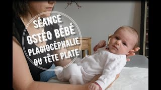 Séance ostéo bébé  plagiocéphalie ou tête plate [upl. by Wulfe525]