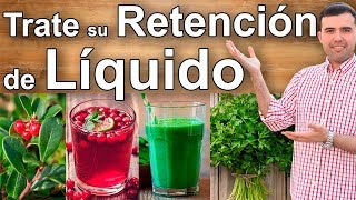 PIES HINCHADOS o RETENCIÓN de LÍQUIDOS 🦶 CAUSAS PREVENCIÓN y TRATAMIENTO 👣 DR IVÁN GUTIÉRREZ ROMERO [upl. by Aroda]