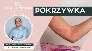 Dermatolog mówi o Pokrzywka [upl. by Audly]