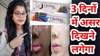 Clinskin Cream  Clinskin Cream honest review in hindi  Clinskin cream Side effects in hindi [upl. by Nojram754]