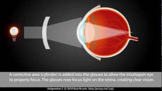 Astigmatism explained Easily Corrected With A Cylinder in Your Eyewear Glasses [upl. by Rakso]