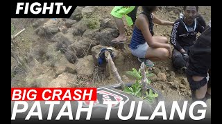 PATAH TULANG  DOWNHILL EXTREME BIG CRASH  FIGHTv [upl. by Anwadal]