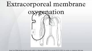 Extracorporeal membrane oxygenation [upl. by Nessi385]