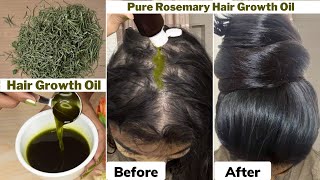 I used👆🏼this Rosemary Hair Growth Oil on Thinning Hair amp Bald ScalpGot 10 times Thick Hair Growth [upl. by Gregorius482]