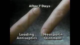 Neosporin Commercial 1991 [upl. by Bergess]