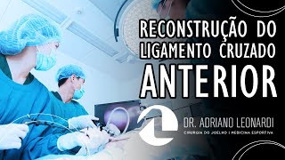 RECONSTRUÇÃO DO LIGAMENTO CRUZADO ANTERIOR  Dr Adriano Leonardi [upl. by Adnwahsal]