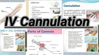 IV Cannulation Procedure GNM Fundamental Guide for Nurses [upl. by Yorled]