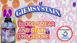 BLOOD SMEAR amp GIEMSA STAIN PROCEDURE [upl. by Aytak214]