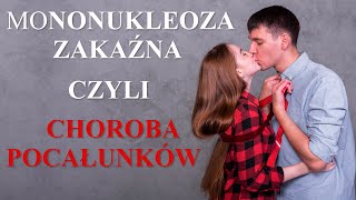 Mononukleoza Zakaźna czyli Choroba Pocałunków Co to jest Jak się zarazić Objawy Leczenie Wirus [upl. by Imelida]