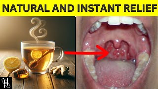 Say Goodbye To SORE THROATS With This Instant Natural Home Remedy [upl. by Yanel609]