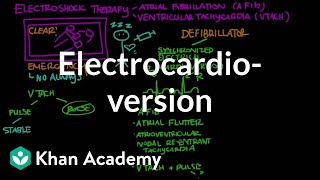 Electrocardioversion  Circulatory System and Disease  NCLEXRN  Khan Academy [upl. by Metzger]