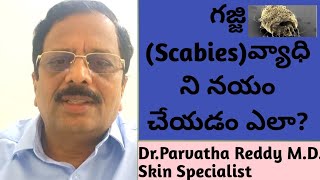 How to cure and control Scabies [upl. by Arvid]