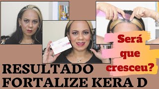 RESULTADO DO CRESCIMENTO CAPILAR FORTALIZE KERA D EXÍMIA veionaglambox [upl. by Akirehs]