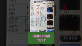 HEMOGRAM TEST REPORT HBRBCWBC PLATELET CBC TEST REPORT [upl. by Medeah]