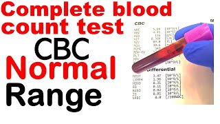 Complete blood count or CBC test normal range [upl. by Auhsoj960]