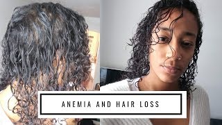 Anemia and Hair Loss  My Natural Hair Journey [upl. by Sitoiganap]