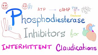 Intermittent Claudications Management [upl. by Jarid753]