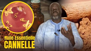 Bienfaits Huile Essentielle de Cannelle  Pr Ousmane Ndiaye  LansarrTV [upl. by Ennaillek919]