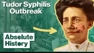 History of syphilis [upl. by Damaris]