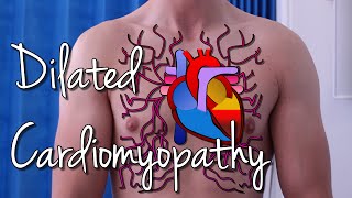 Dilated Cardiomyopathy [upl. by Kaleb]