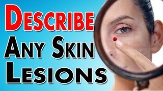 Describing Skin Lesions [upl. by Anaela276]