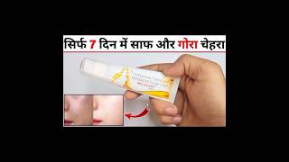 Melacare Cream Review in Hindi मेलाकेयर क्रीम के फायदे नुकसान उपयोग [upl. by Kenyon347]