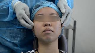 PIDC VIDEOS  ORAL amp MAXILLOFACIAL SURGERY  Examination [upl. by Delfine]